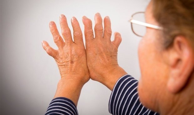 La combinación de estas terapias permitiría combatir la artritis. Foto: La República.